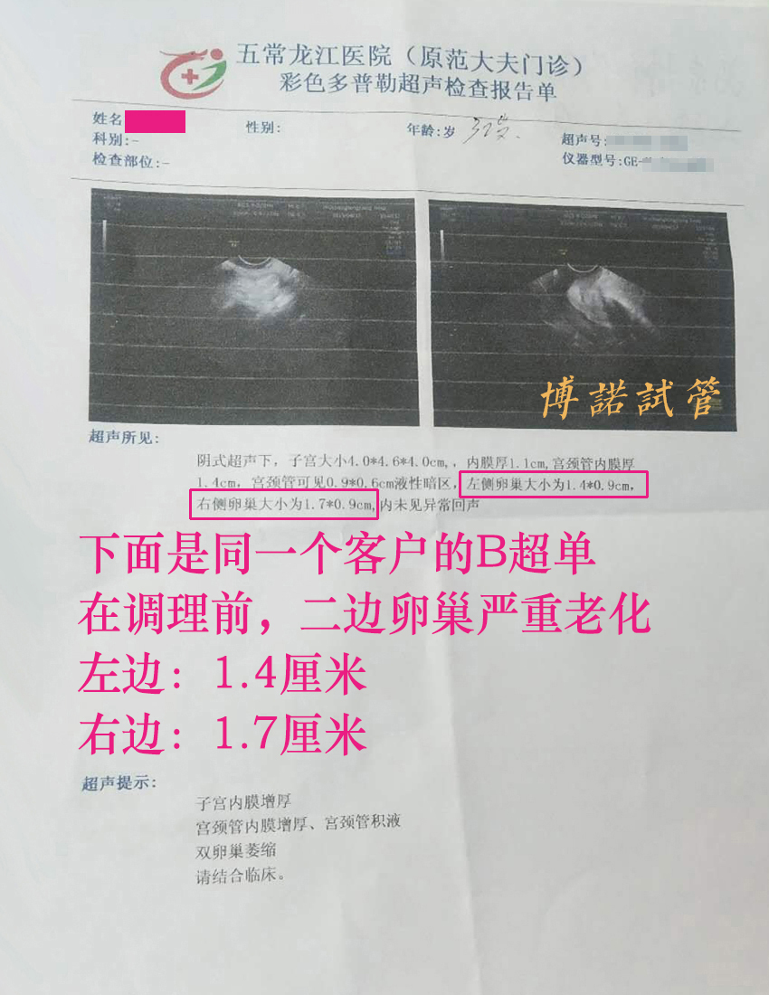 法国借卵成功率.jpg