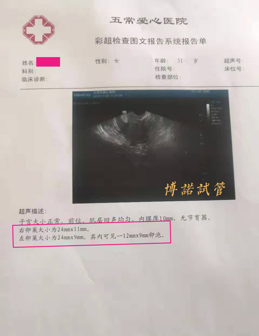 法国借卵费用.jpg