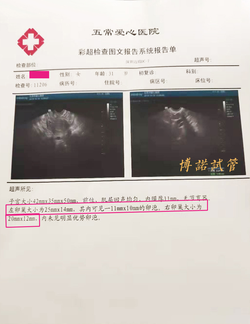 法国借卵生子.jpg