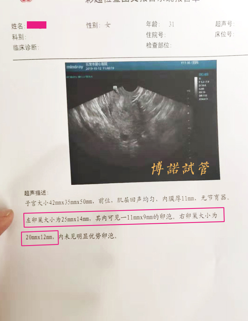 法国借卵试管医院.jpg