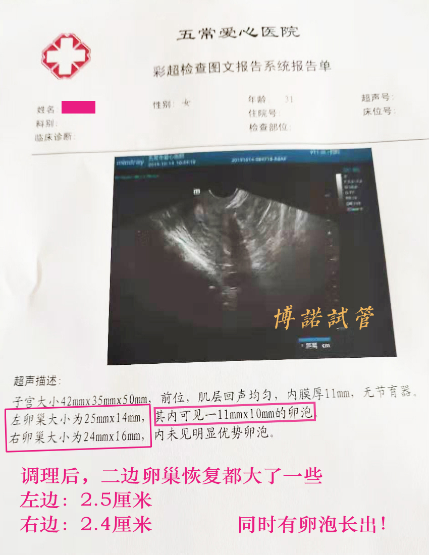 法国借卵怀孕经历.jpg