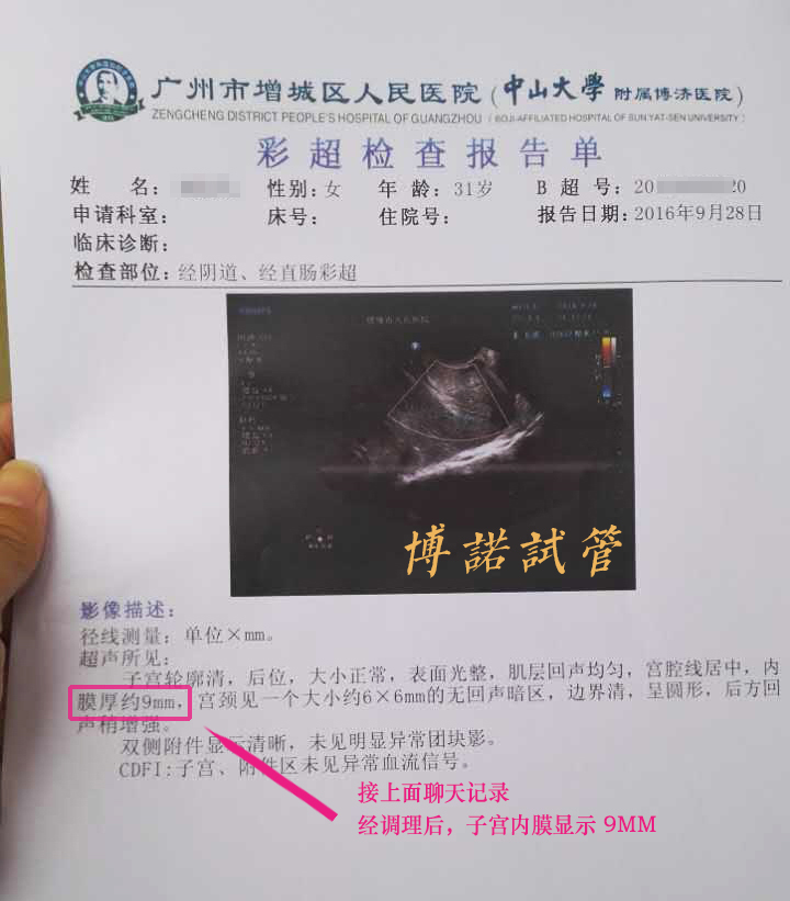 法国借卵试管婴儿费用.jpg