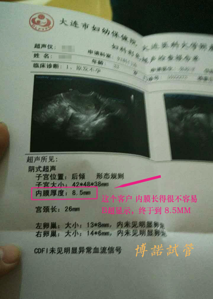 法国借卵试管婴儿.jpg